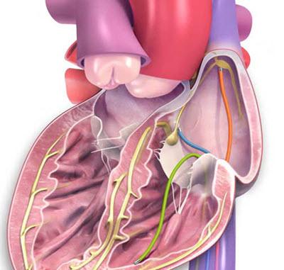 心脏图显示心电图的导联